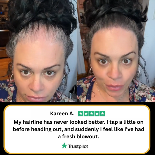 LANLSLO™ Hairline Powder
