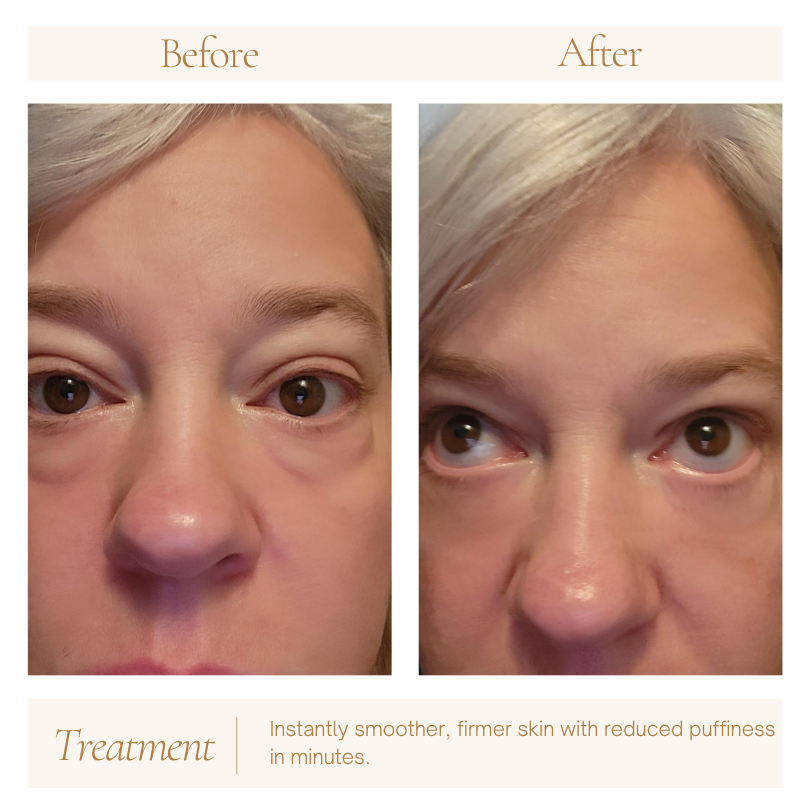 Solrise Eye Lift – Instant Firming & Smoothing