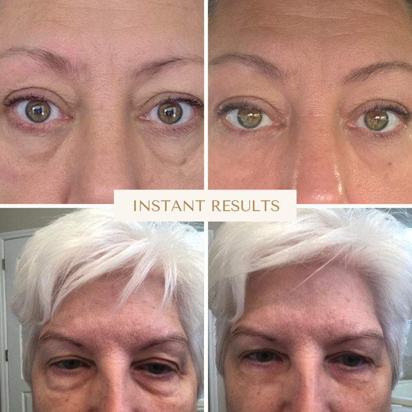 Solrise Eye Lift – Instant Firming & Smoothing