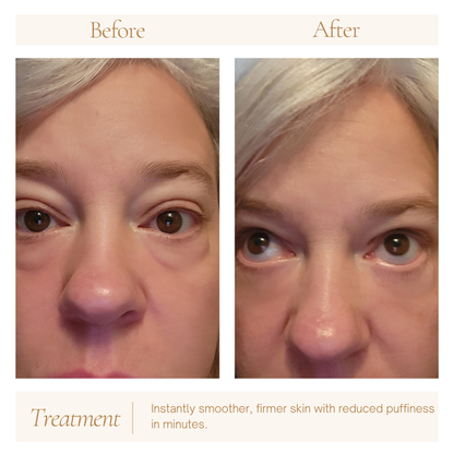Solrise Eye Lift – Instant Firming & Smoothing